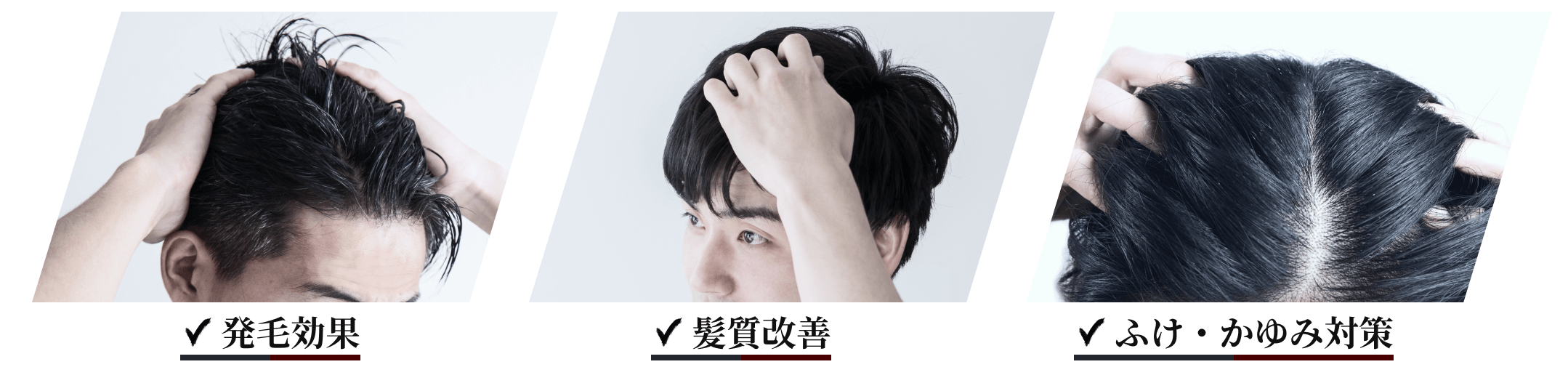 発毛効果 髪質改善 ふけ・かゆみ対策