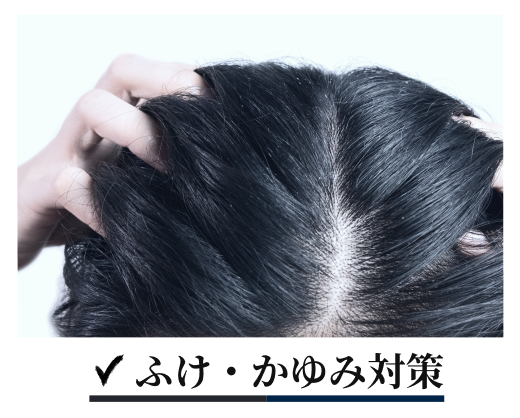 ふけ・かゆみ対策